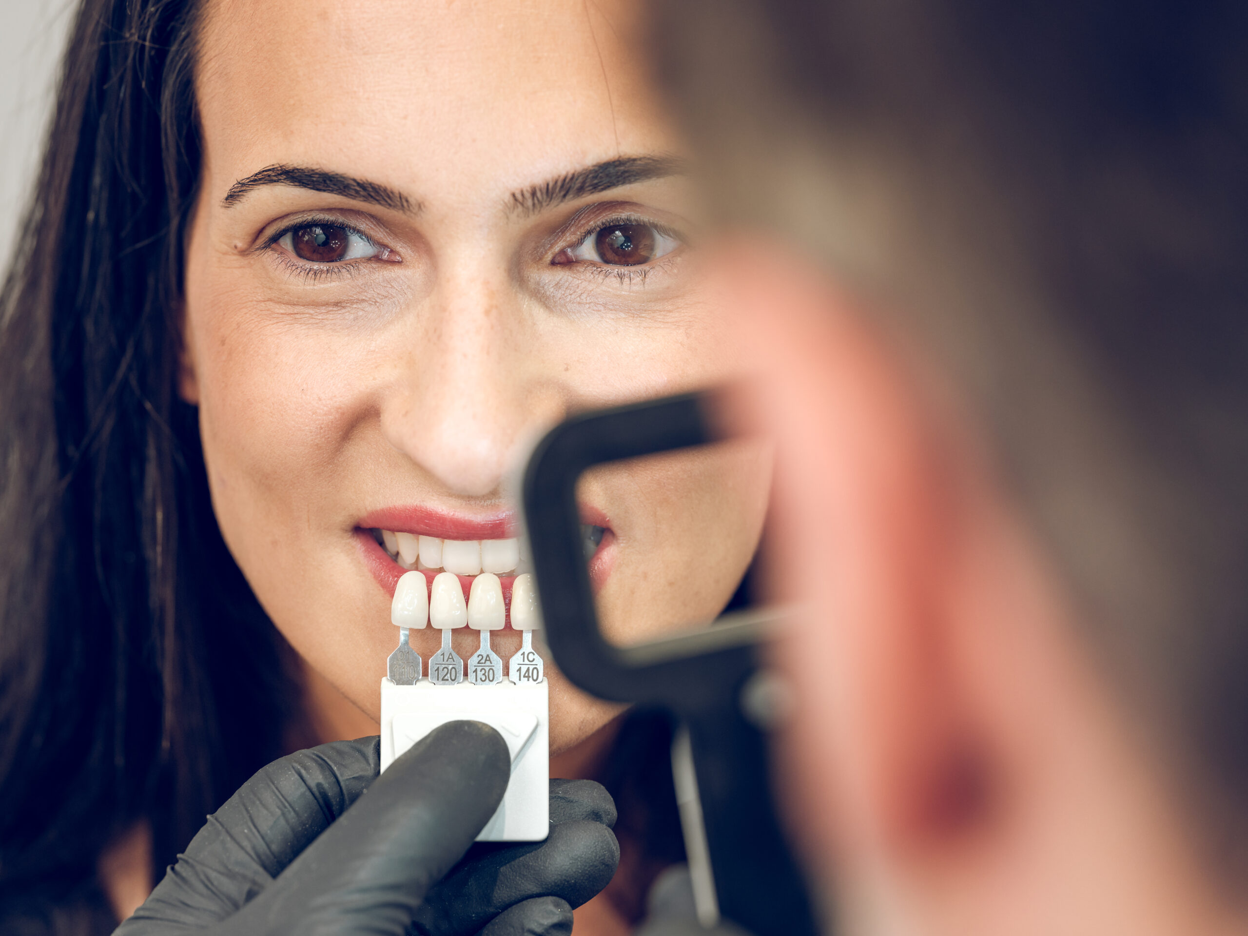 MR_ID14885_14820_JoseVidal.jpg, MR_ID14885_13927_VanessaCarcellerCornejo.jpg Dark haired lady looking at camera while crop blurred dentist selecting hue of teeth with loupe and shade scale